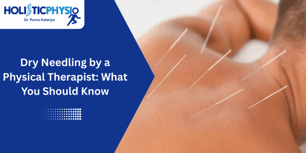 Dry Needling by a Physical Therapist: What You Should Know